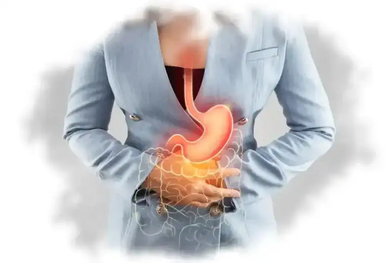 علاج حموضة المعدة