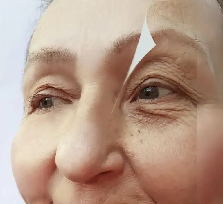 علامات الشيخوخة